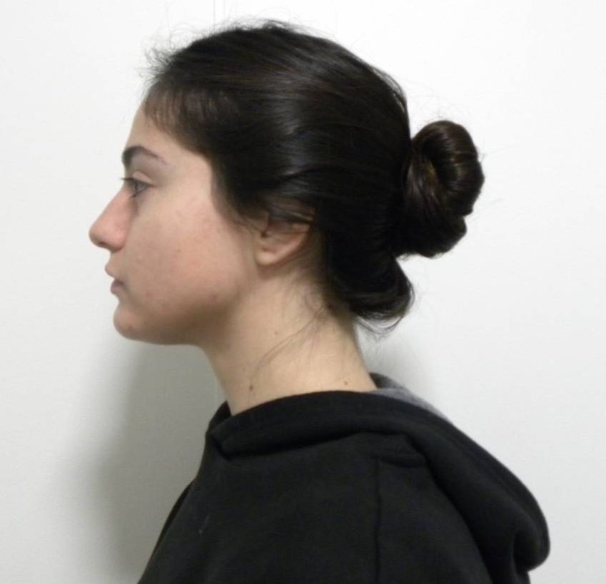 Lateral estricta izquierda