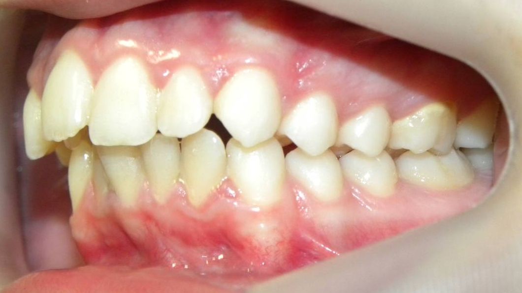 Lateral Izquierda