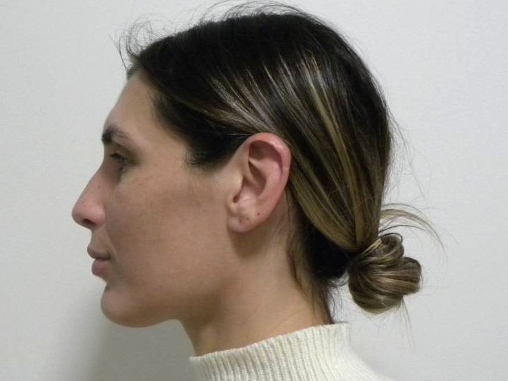 Lateral estricta izquierda