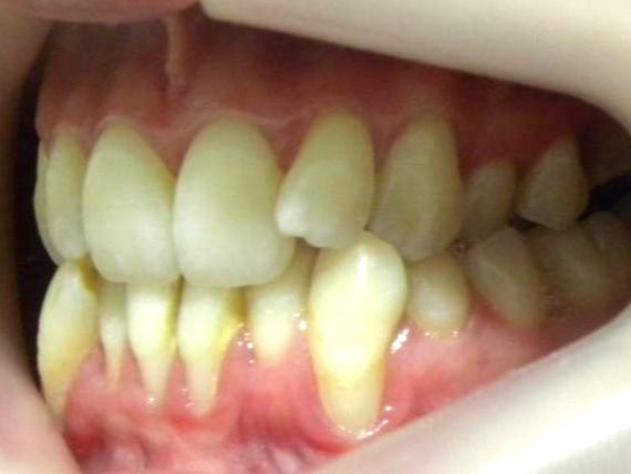 Lateral Izquierda