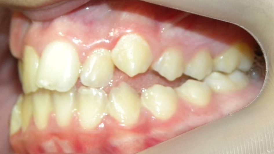 Lateral Izquierda
