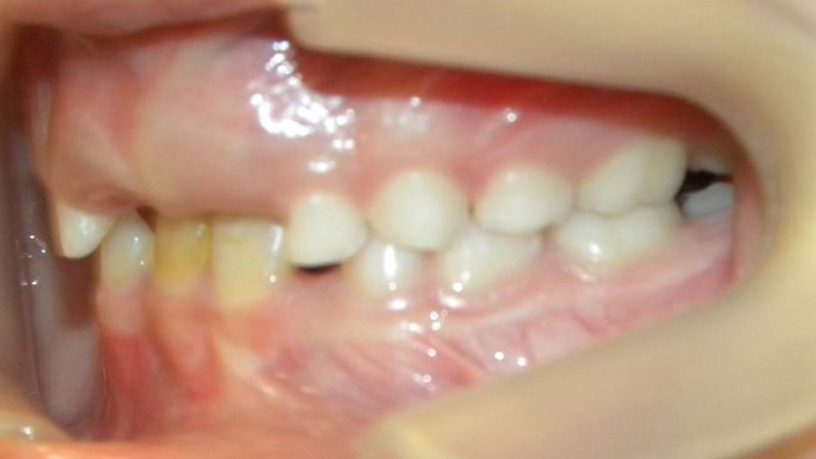 Lateral Izquierda