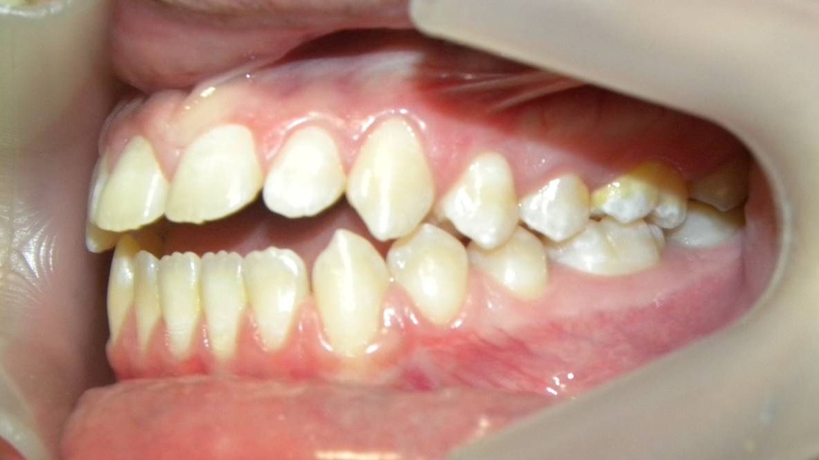 Lateral Izquierda