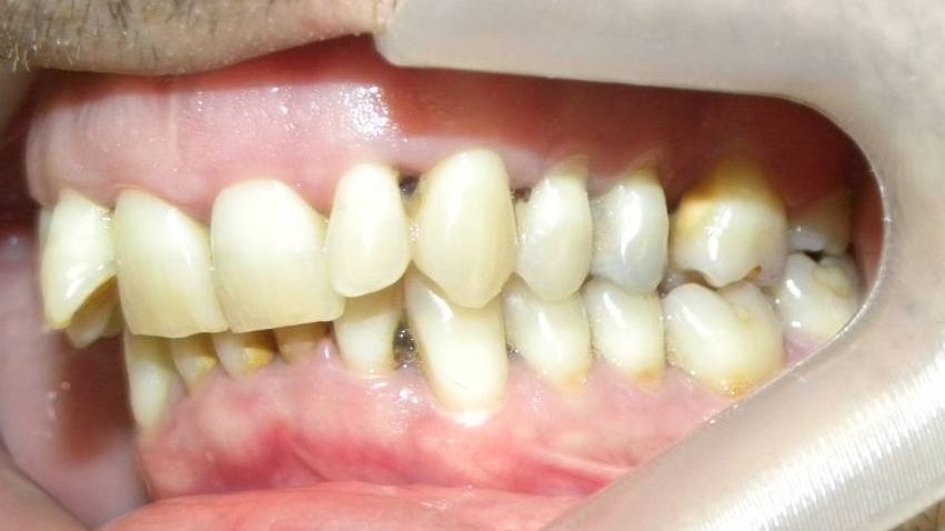 Lateral Izquierda