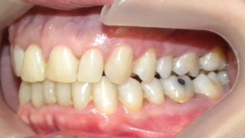 Lateral Izquierda