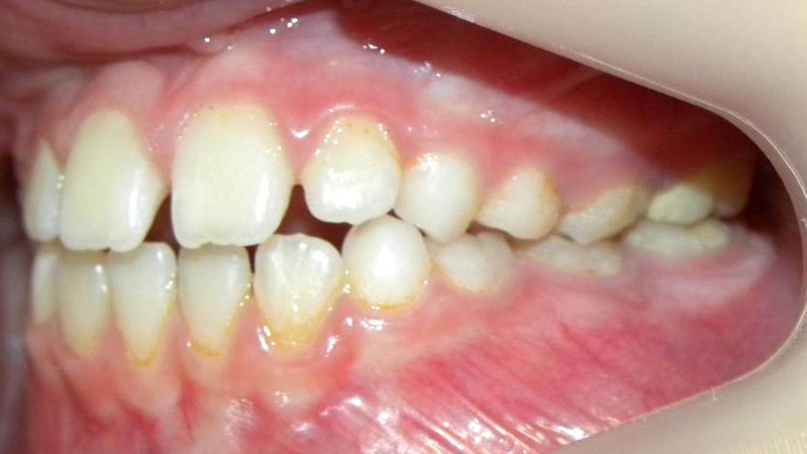 Lateral Izquierda
