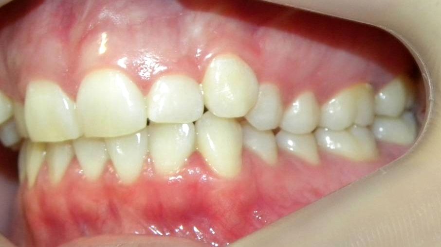 Lateral Izquierda