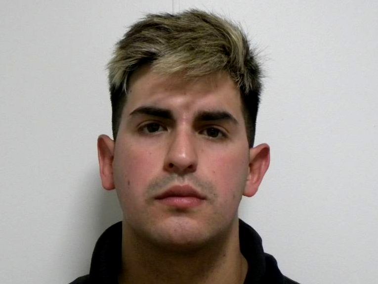 Frontal en reposo