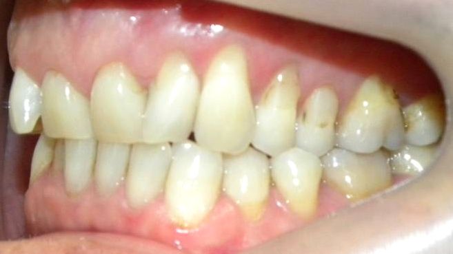 Lateral Izquierda