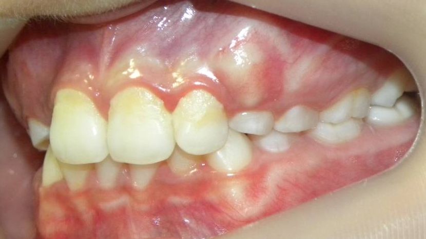 Lateral Izquierda