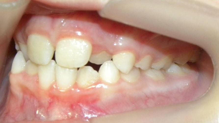 Lateral Izquierda