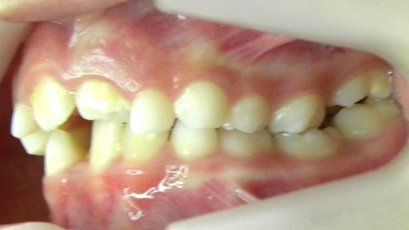 Lateral Izquierda