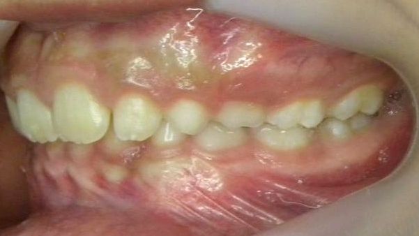 Lateral Izquierda