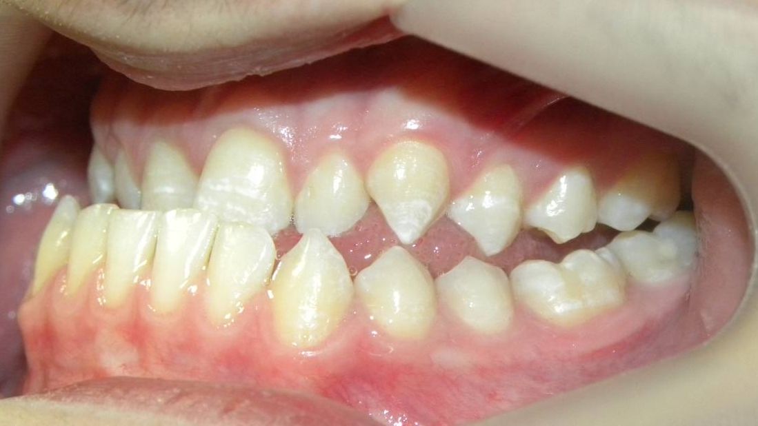 Lateral Izquierda