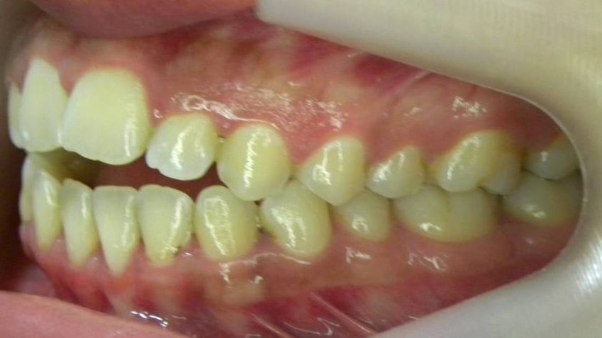 Lateral Izquierda