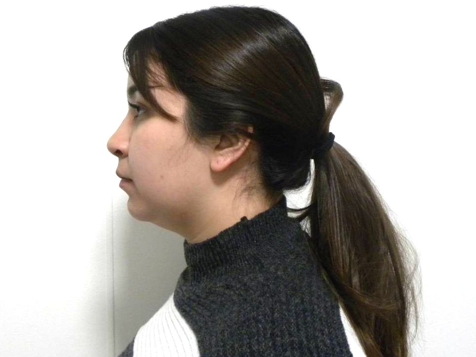 Lateral estricta izquierda