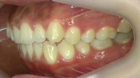 Lateral Izquierda