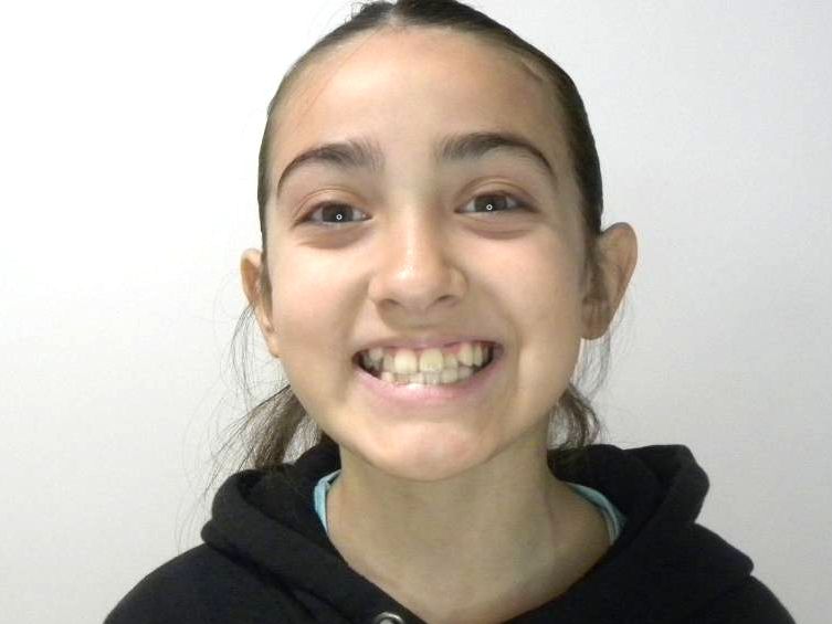 Frontal sonriendo