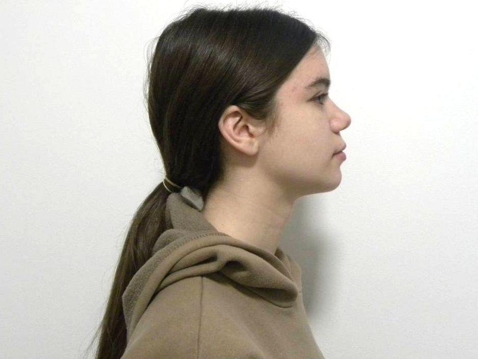 Lateral estricta derecha