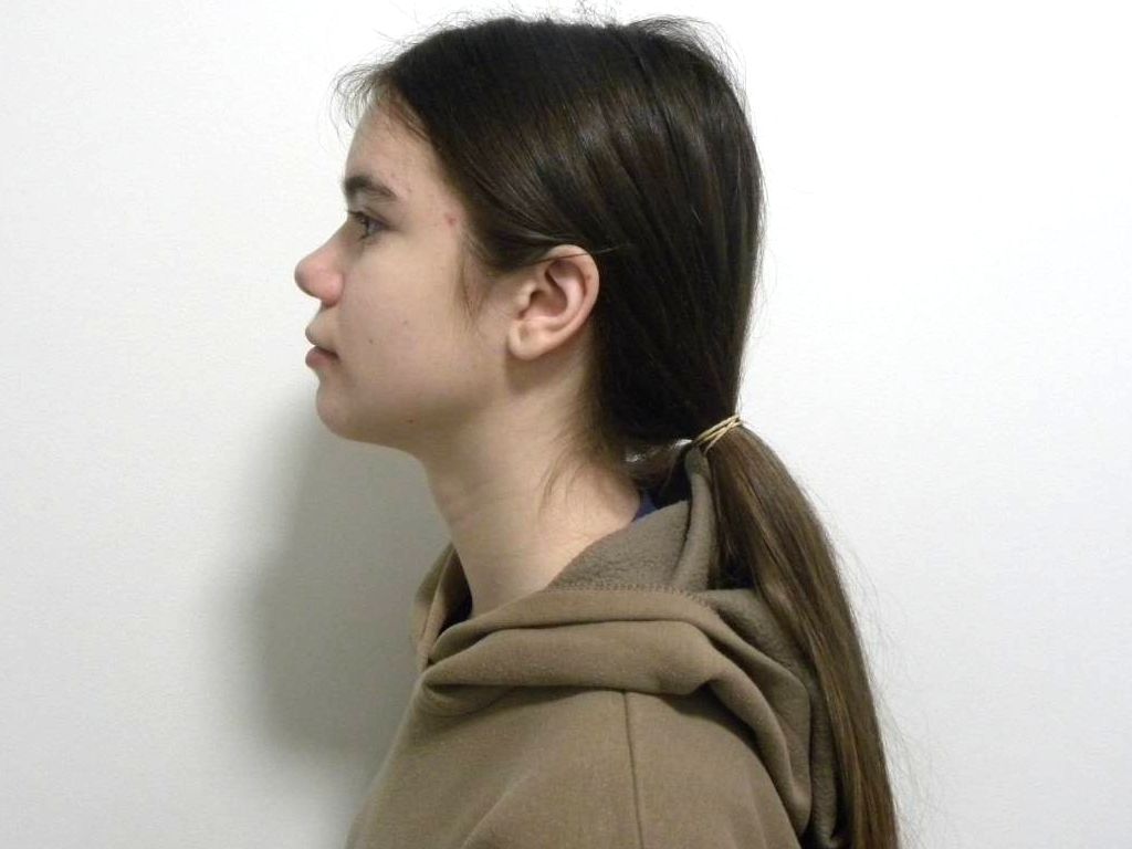 Lateral estricta izquierda