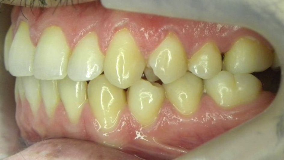 Lateral Izquierda