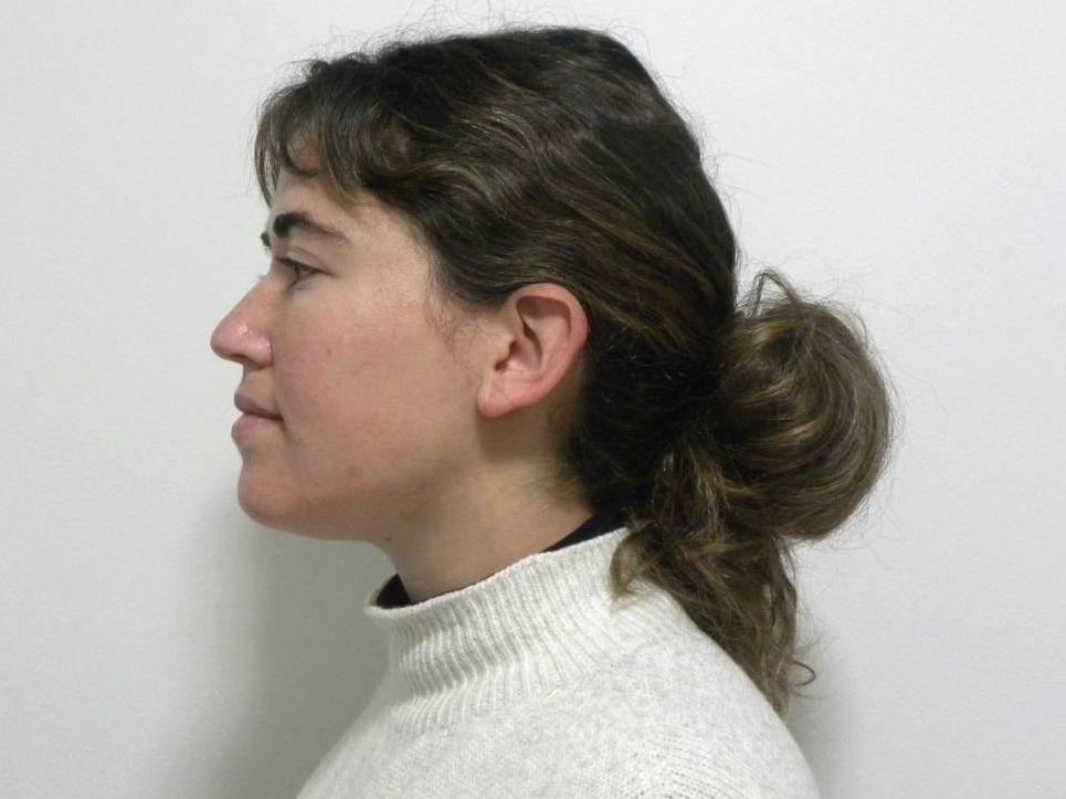 Lateral estricta izquierda