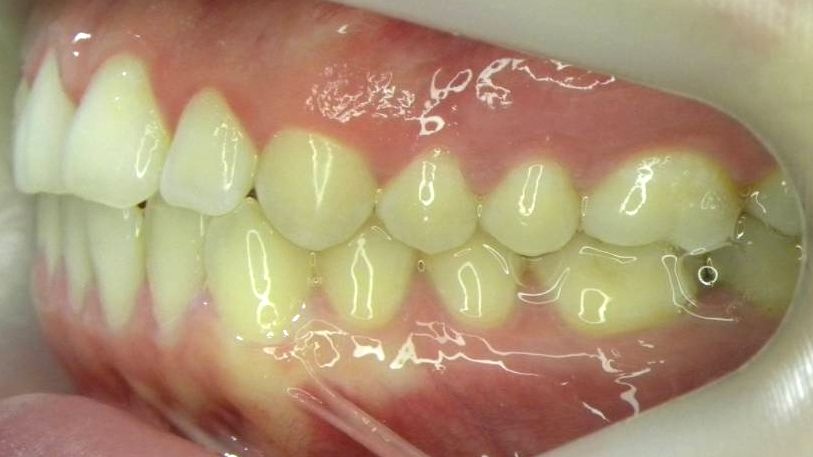 Lateral Izquierda