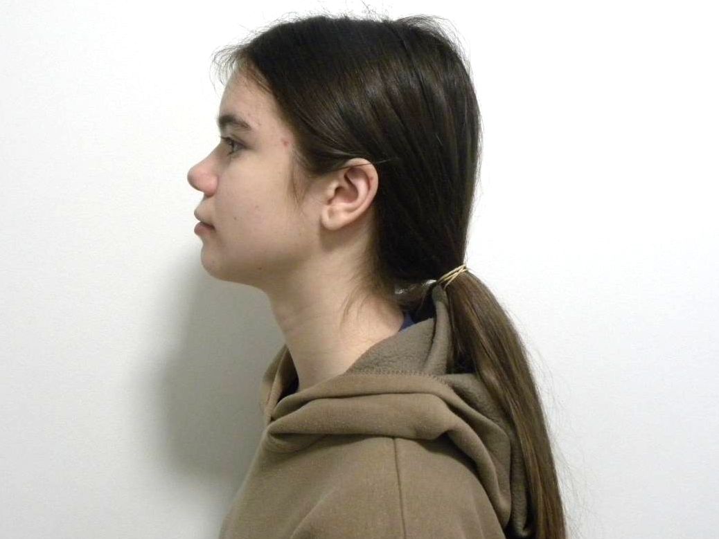 Lateral estricta izquierda