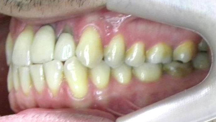 Lateral Izquierda