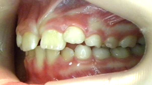 Lateral Izquierda