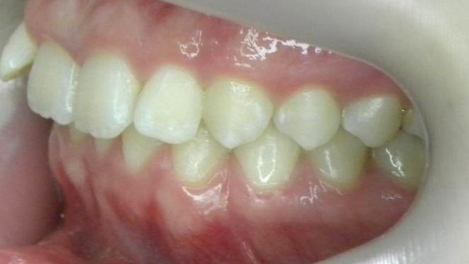 Lateral Izquierda