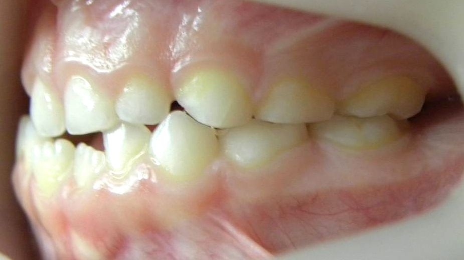 Lateral Izquierda