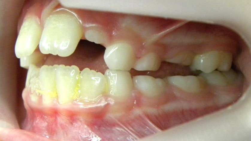 Lateral Izquierda