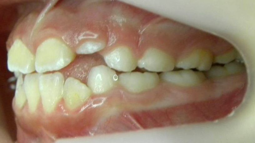 Lateral Izquierda