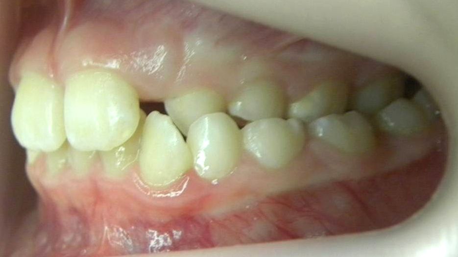 Lateral Izquierda