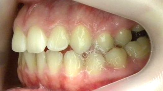 Lateral Izquierda