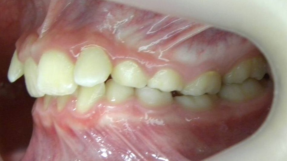 Lateral Izquierda