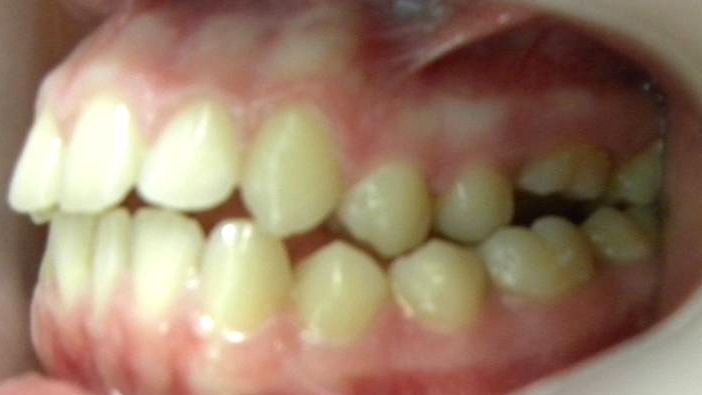 Lateral Izquierda