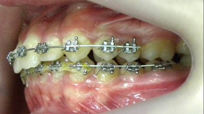 Lateral Izquierda