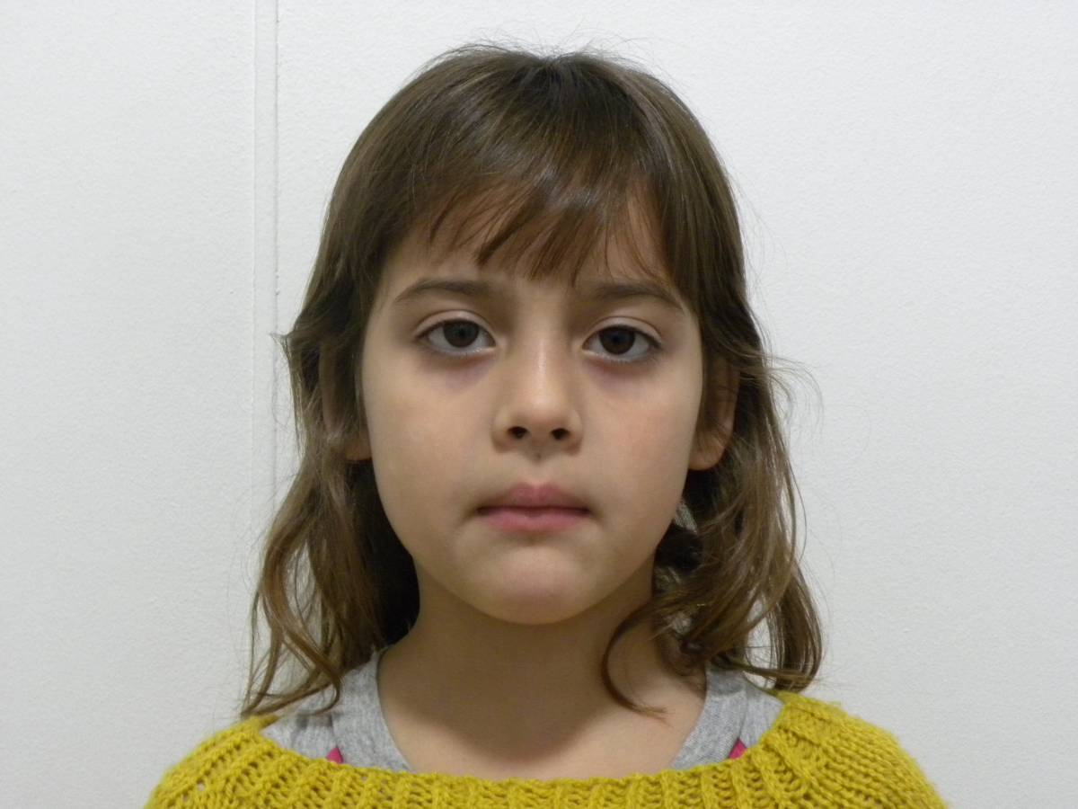 Frontal en reposo