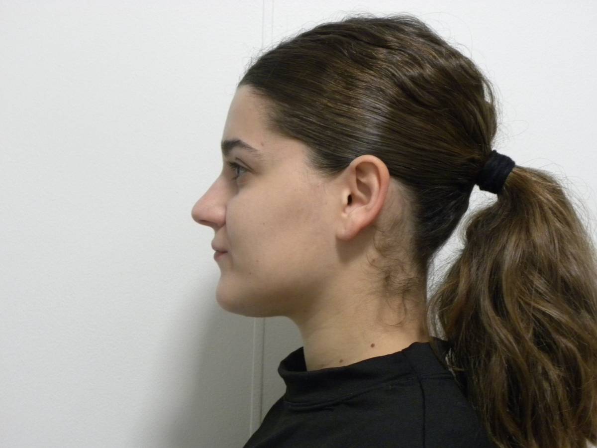 Lateral estricta derecha